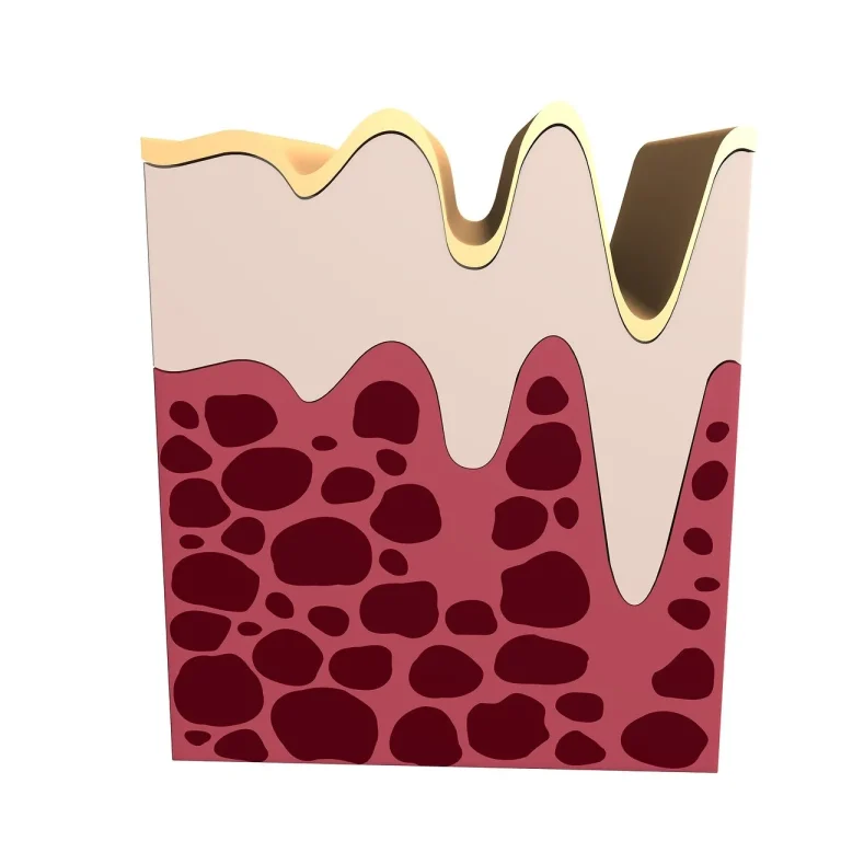 lipsa colagen simptome
