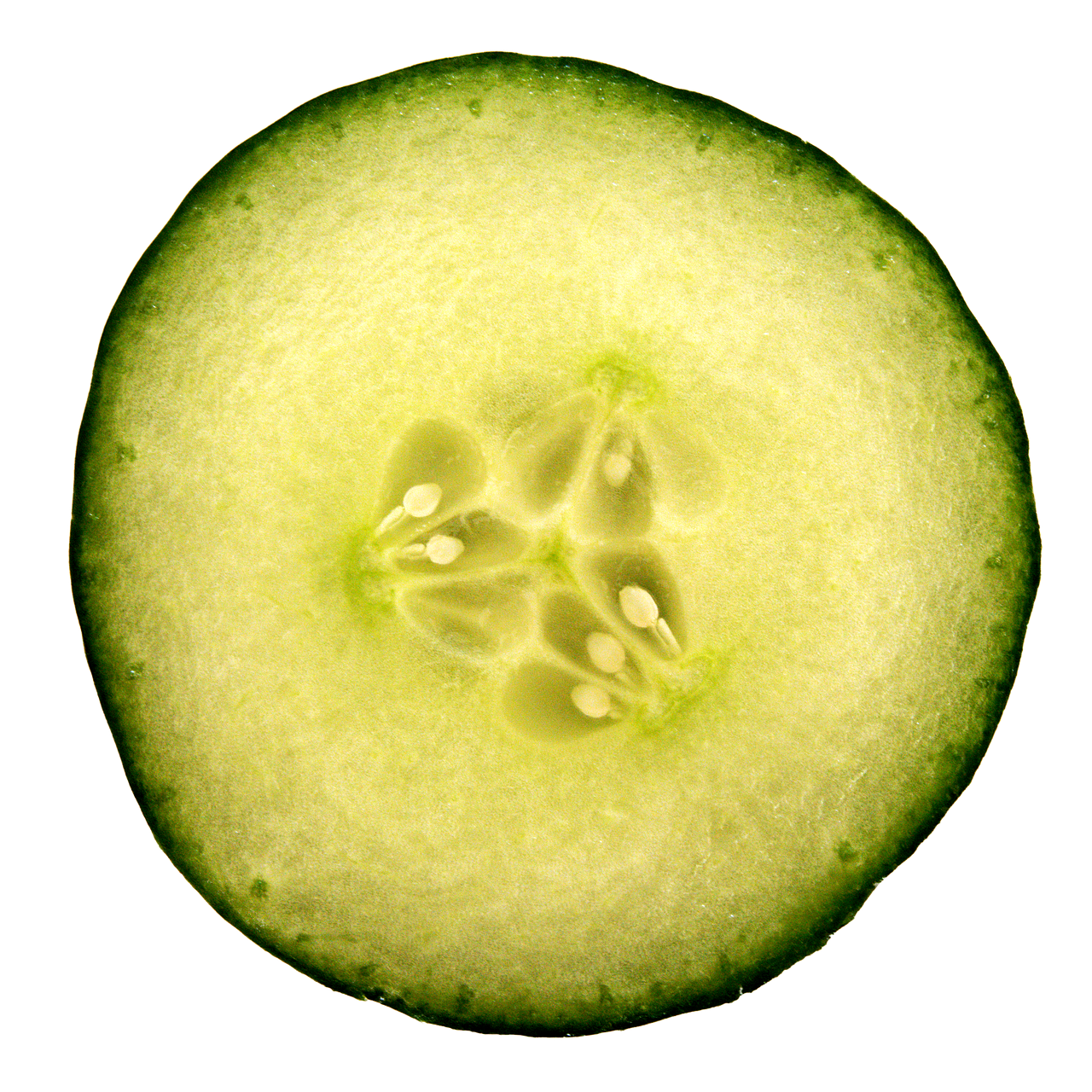 ce inseamna carcinom scuamocelular keratinizat